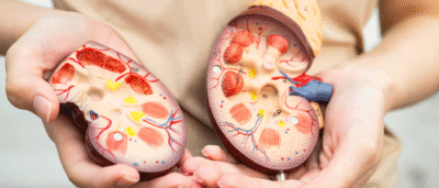 Doença Renal Crônica